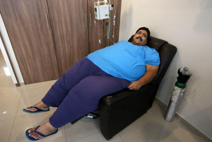 Worlds Fattest Man Weighing 444 Kgs Dies After Drinking Too Many